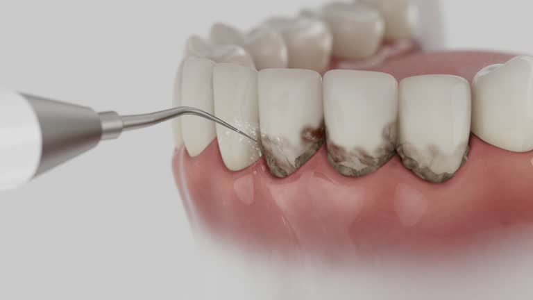 Reliable Emergency Dentist contractor in Conover, NC by Smile Center Dentistry